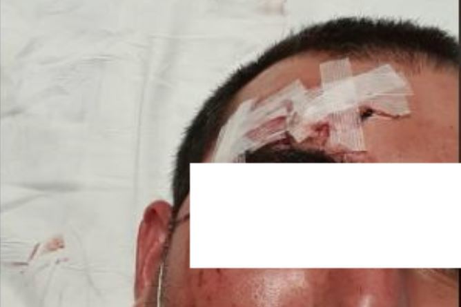 Imagen del camionero agredido
