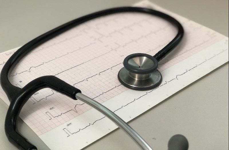 Imagen de un electrocardiograma