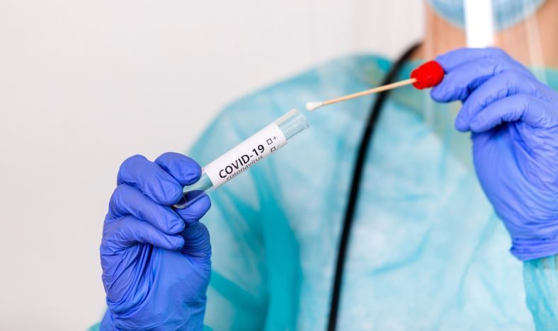 Imagen de una prueba PCR