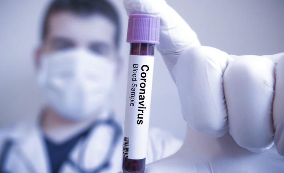 Imagen de un test de coronavirus